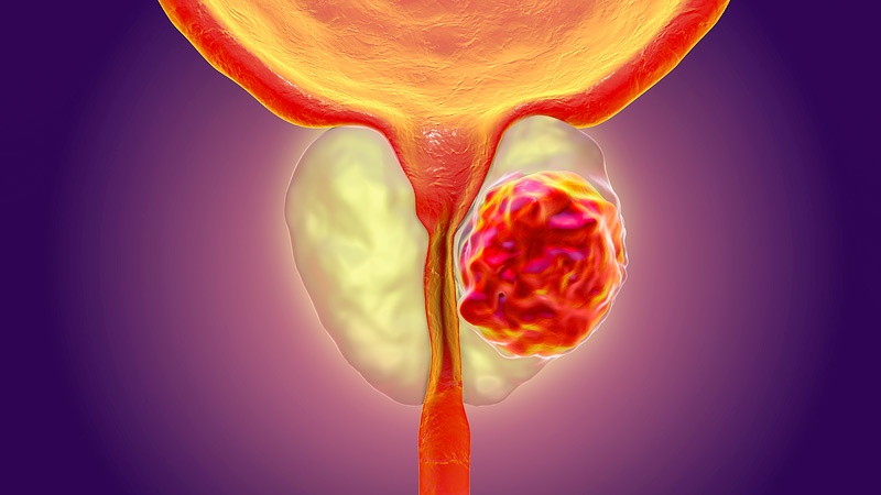  US issues new advisory linking alcohol to cancer 
