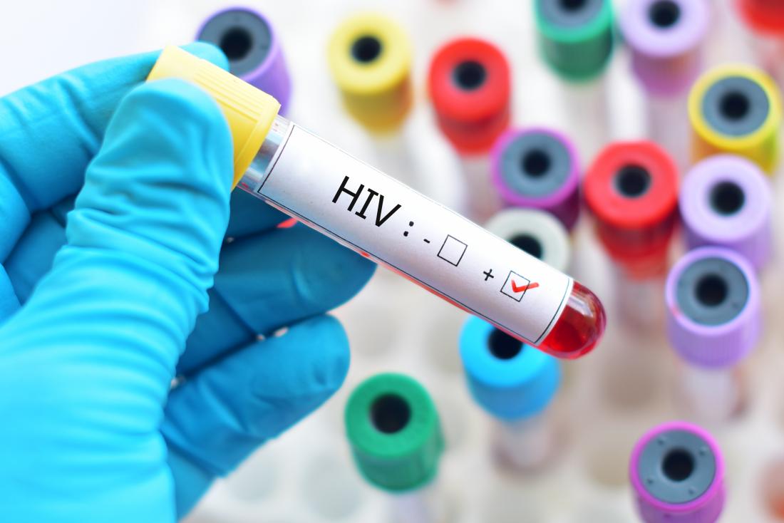  FEC approves N4 8bn for HIV treatment 