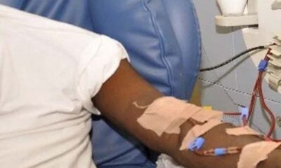  US citizens others rushing to Nigeria for kidney transplant Shettima 