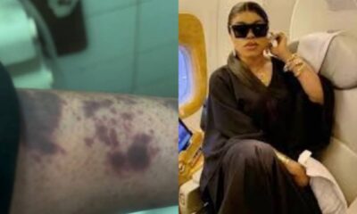  Bobrisky removed from Amsterdam bound flight claims injuries from immigration officers 