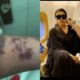  Bobrisky removed from Amsterdam bound flight claims injuries from immigration officers 