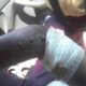  LASTMA official set on fire by bus driver conductor in Lagos 