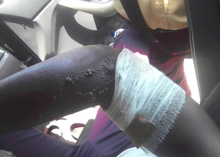 LASTMA official set on fire by bus driver conductor in Lagos LASTMA official set on fire by bus driver conductor in Lagos