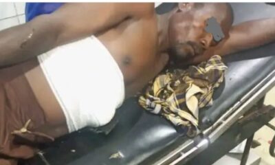  Abuja Herbalist lands in critical condition while testing bulletproof charm on self 