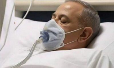  Israeli Prime Minister Netanyahu to undergo another surgery Sunday 