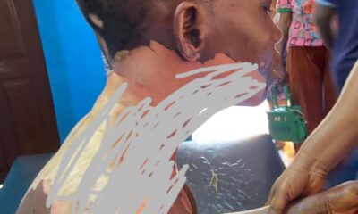  Man arrested for reportedly p0uring h0t oil on wife during argument 