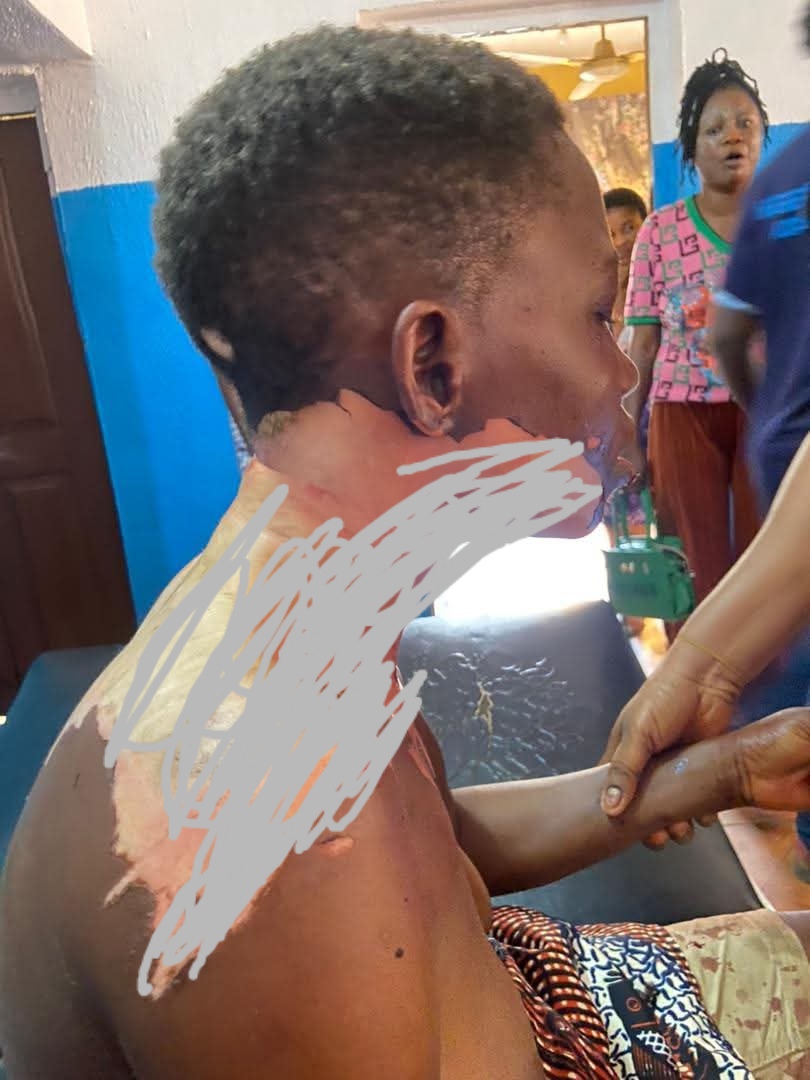Man arrested for reportedly p0uring h0t oil on wife during argument Man arrested for reportedly p0uring h0t oil on wife during argument
