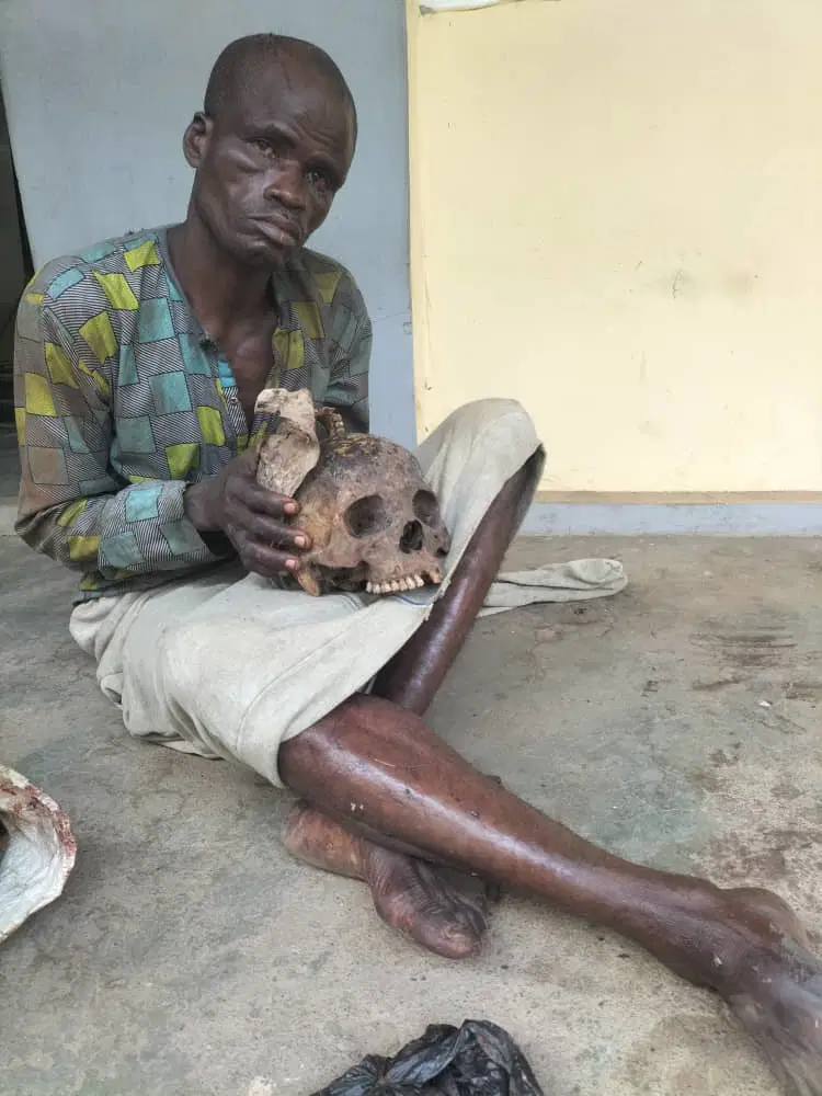 Man arrested with human skull in Ogun Man arrested with human skull in Ogun