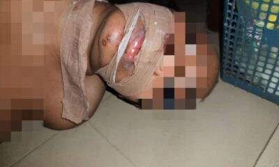  Police rescue woman from suspected ritualist in Abuja hotel 