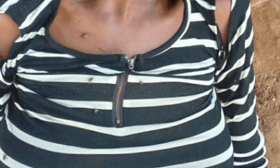  Woman arrested for biting off lover s manhood during dispute over s x 