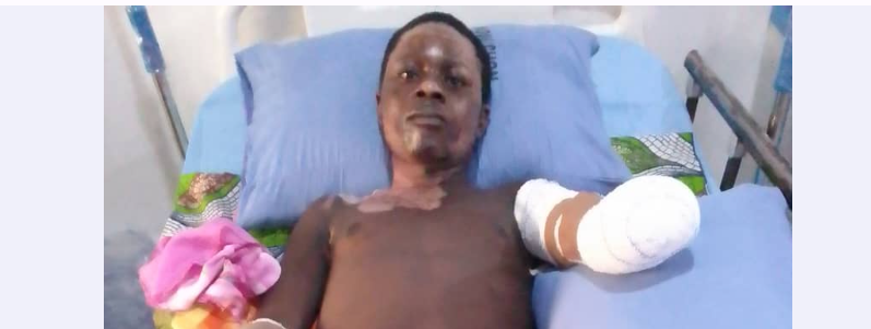 Taraba Poly student loses both hands after tragic electrocution while hoisting party flag Taraba Poly student loses both hands after tragic electrocution while hoisting party flag