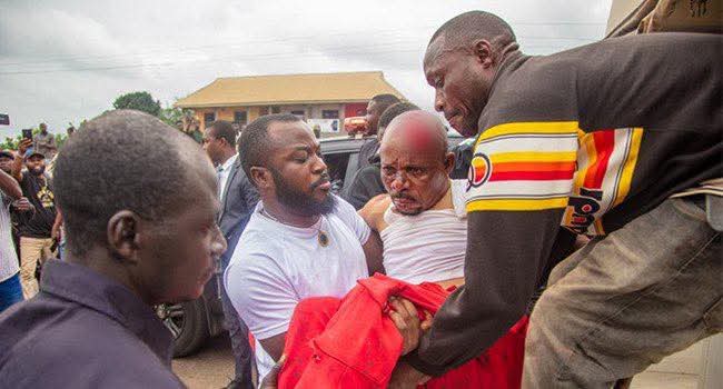 Gov Okpebholo rushes over 10 highway crash victims to hospital Gov Okpebholo rushes over 10 highway crash victims to hospital