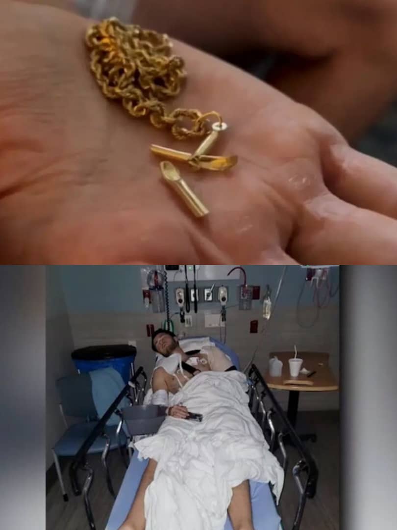  Man saved after Christian cross necklace deflects bullet in near fatal shooting 