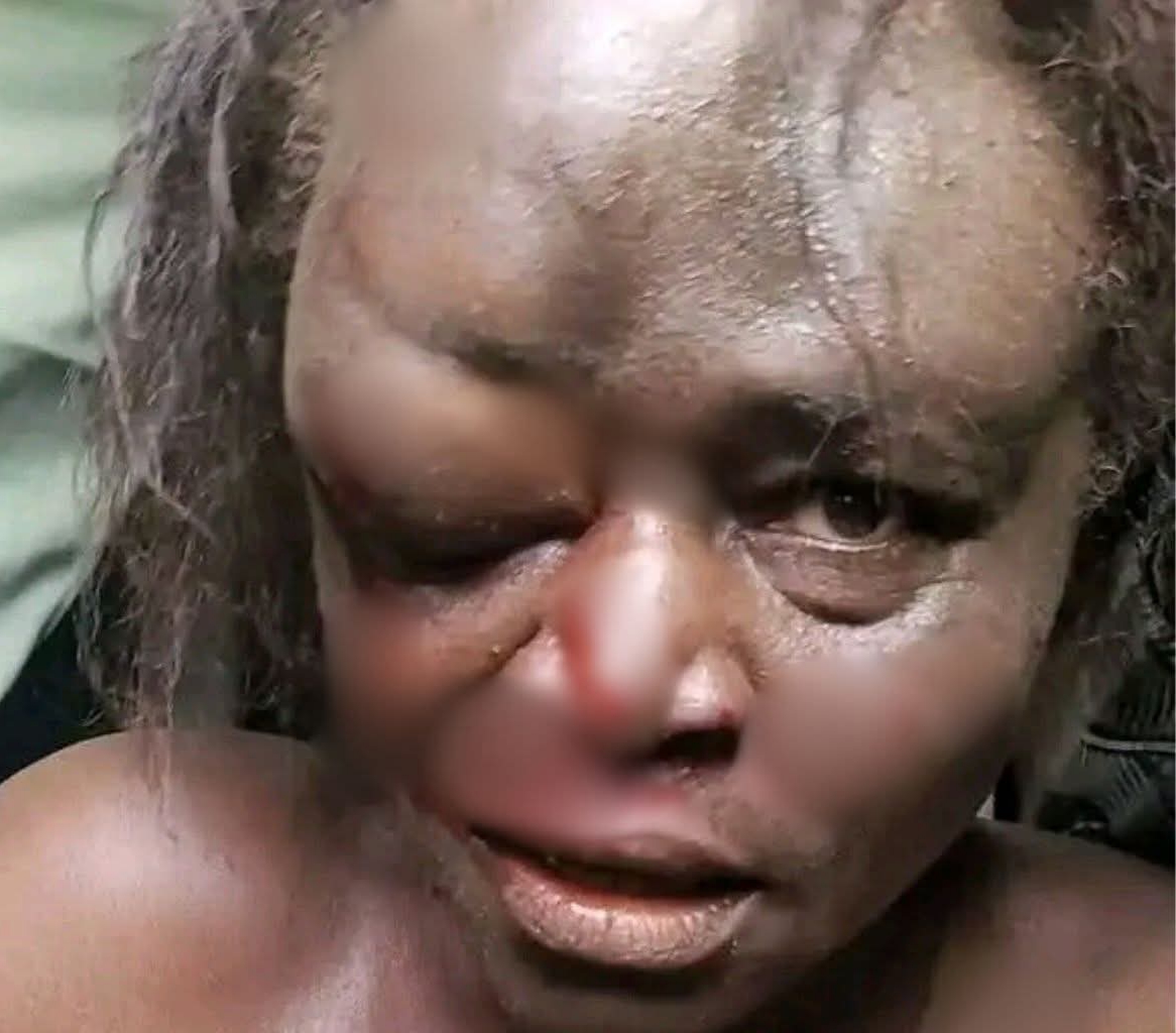  Woman mistaken for child kidnapper dies after mob attack 