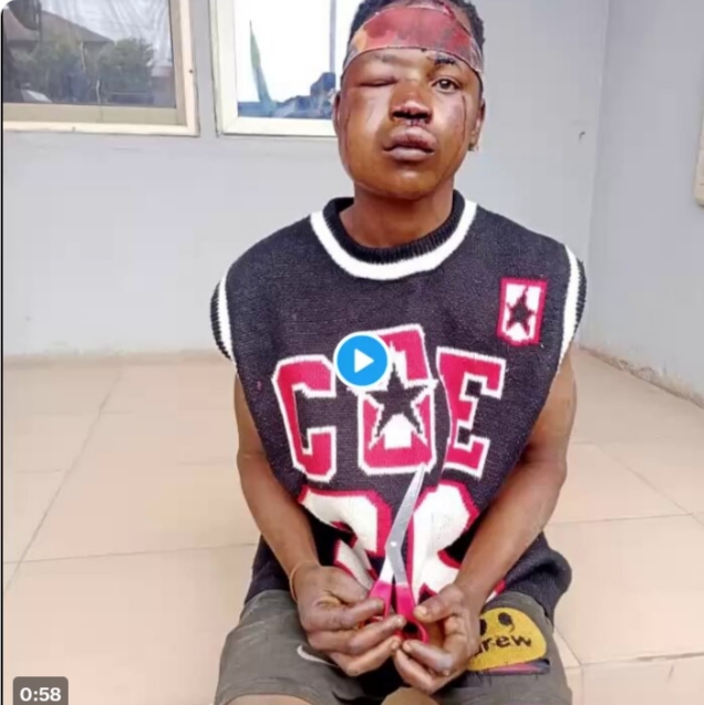 Suspected thief cheats death during mob attack in Lagos Suspected thief cheats death during mob attack in Lagos