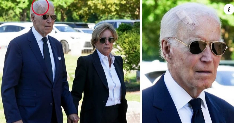 Biden seen with large head bandage after cancer surgery Biden seen with large head bandage after cancer surgery