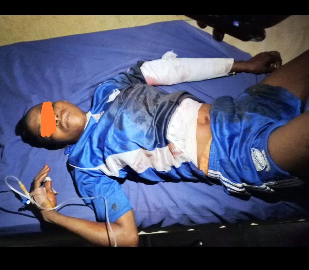 Stray bullets hit students as troops clash with bandits in Benue Stray bullets hit students as troops clash with bandits in Benue